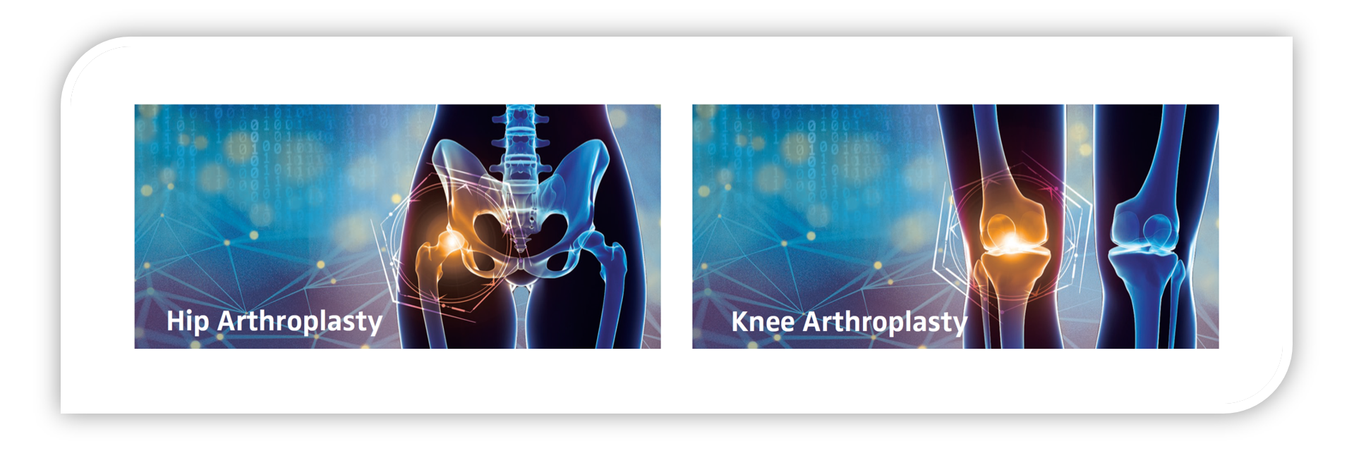 Hip and Knee Arthroplasty Images from AJRR 2020 Annual Report