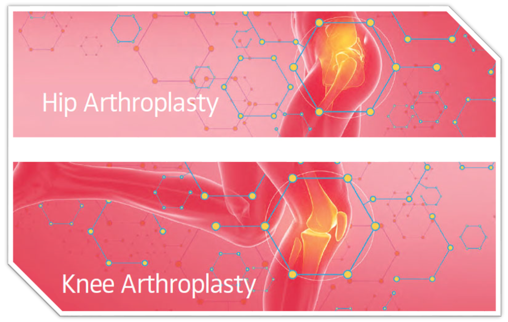 Hip and Knee Arthroplasty Images from the AJRR 2018 Annual Report